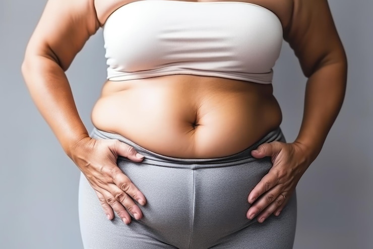 Do you gain weight after gastric balloon in Dubai?